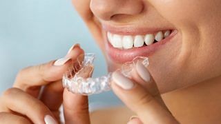 All you need to know about teeth whitening
