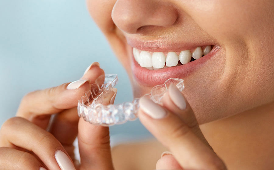 All you need to know about teeth whitening