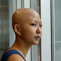 SG woman shares her struggle with hair loss & gets huge support online now thumbnail.jpg